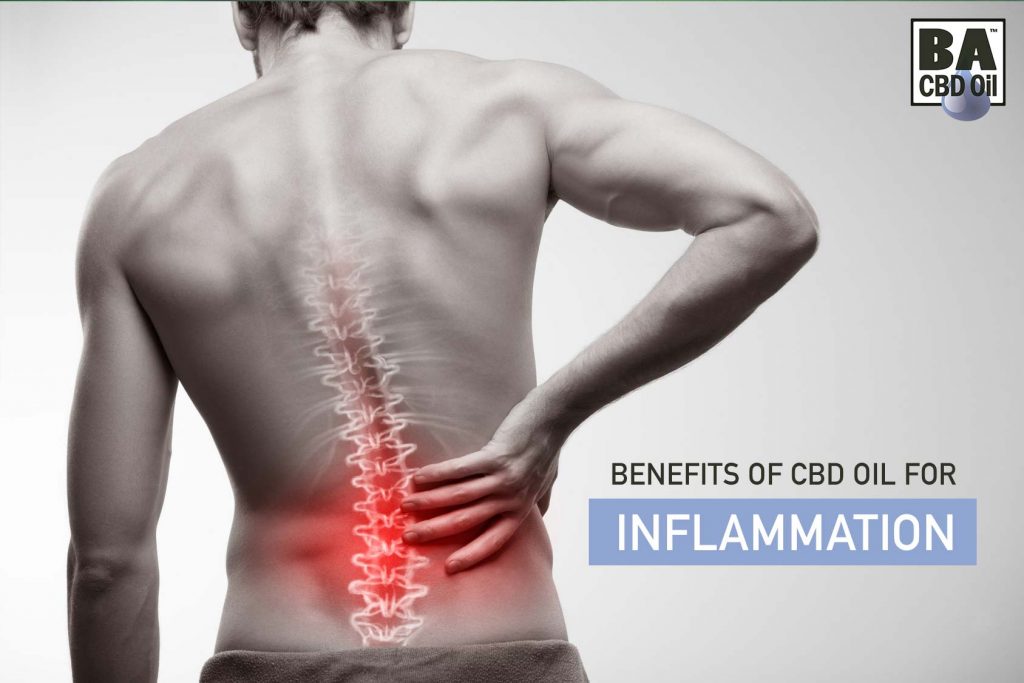 CBD Oil For Inflammation